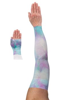 LympheDIVAS Luna Lymphoedema Sleeve and Gauntlet Set