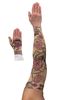 Begonia Lymphoedema Sleeve and Gauntlet Set