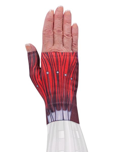 Cyborg Lymphoedema Gauntlet